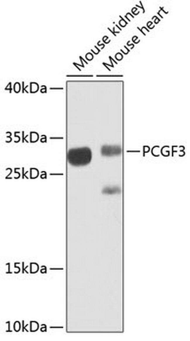 RNF3 Antibody in Western Blot (WB)