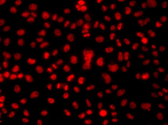 hnRNP A1 Antibody in Immunocytochemistry (ICC/IF)