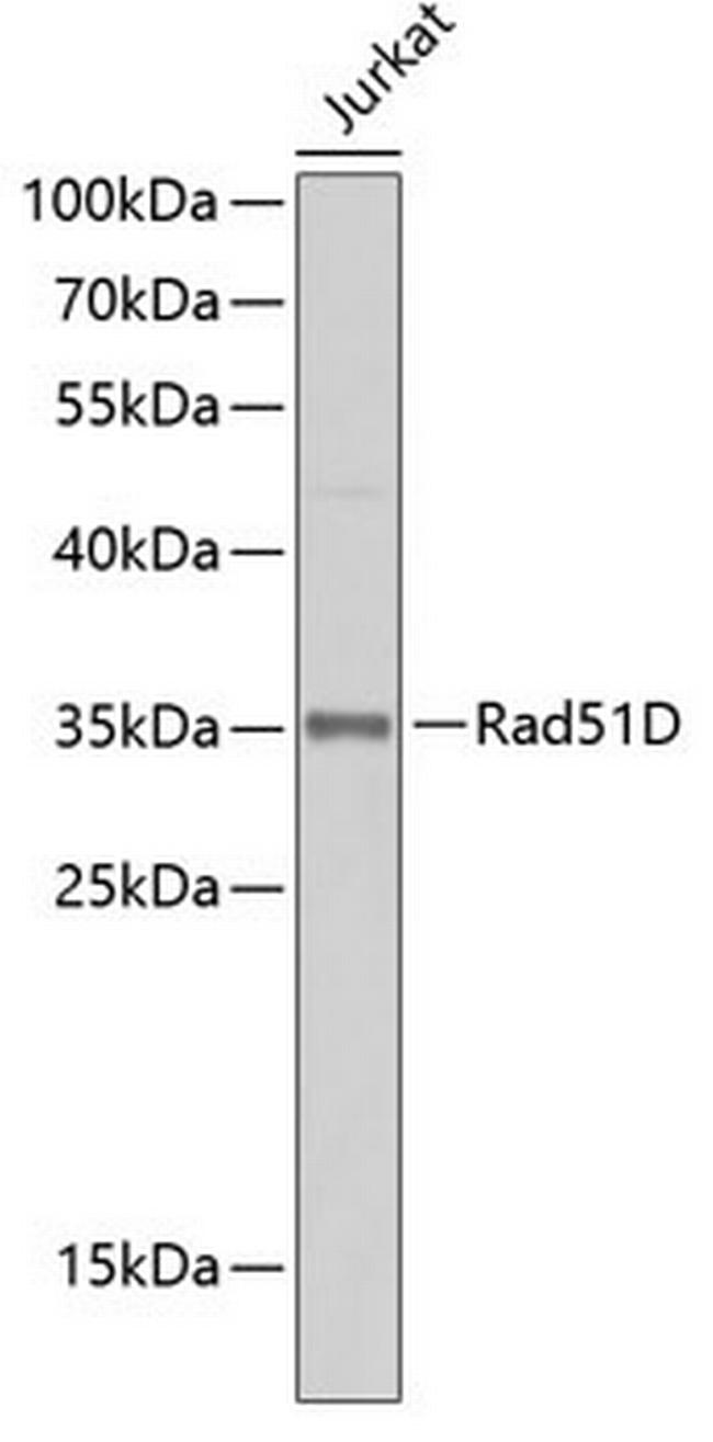 RAD51D Antibody in Western Blot (WB)