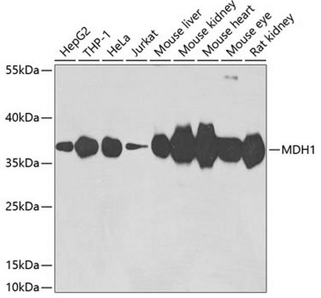 MDH1 Antibody in Western Blot (WB)