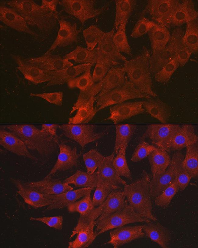 CCL3 Antibody in Immunocytochemistry (ICC/IF)