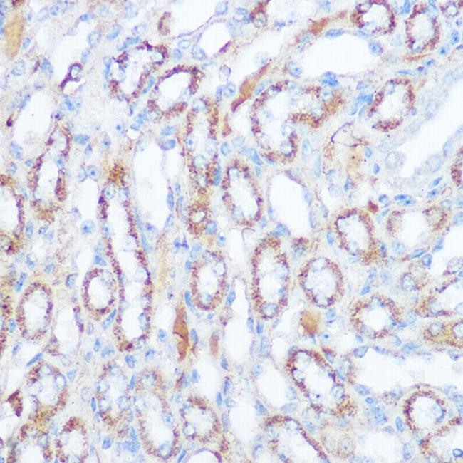 SIRT4 Antibody in Immunohistochemistry (Paraffin) (IHC (P))