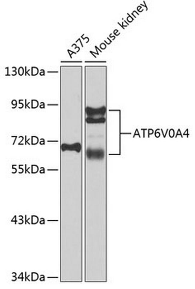 ATP6V0A4 Antibody in Western Blot (WB)