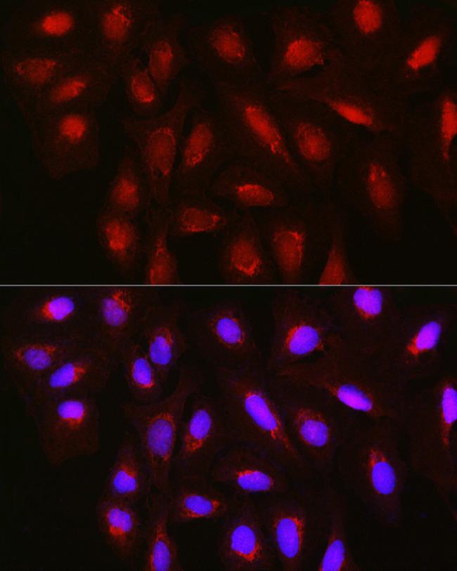 TET3 Antibody in Immunocytochemistry (ICC/IF)