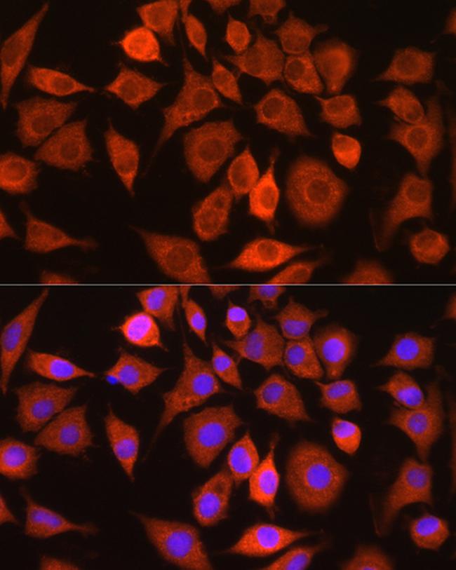 Bax Antibody in Immunocytochemistry (ICC/IF)