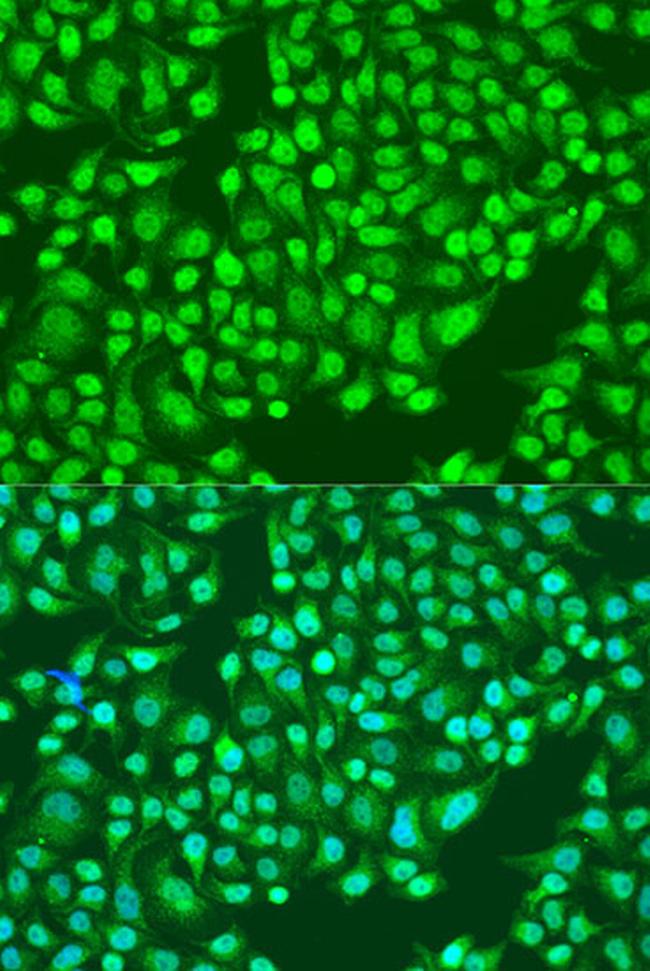 CD49b (Integrin alpha 2) Antibody in Immunocytochemistry (ICC/IF)