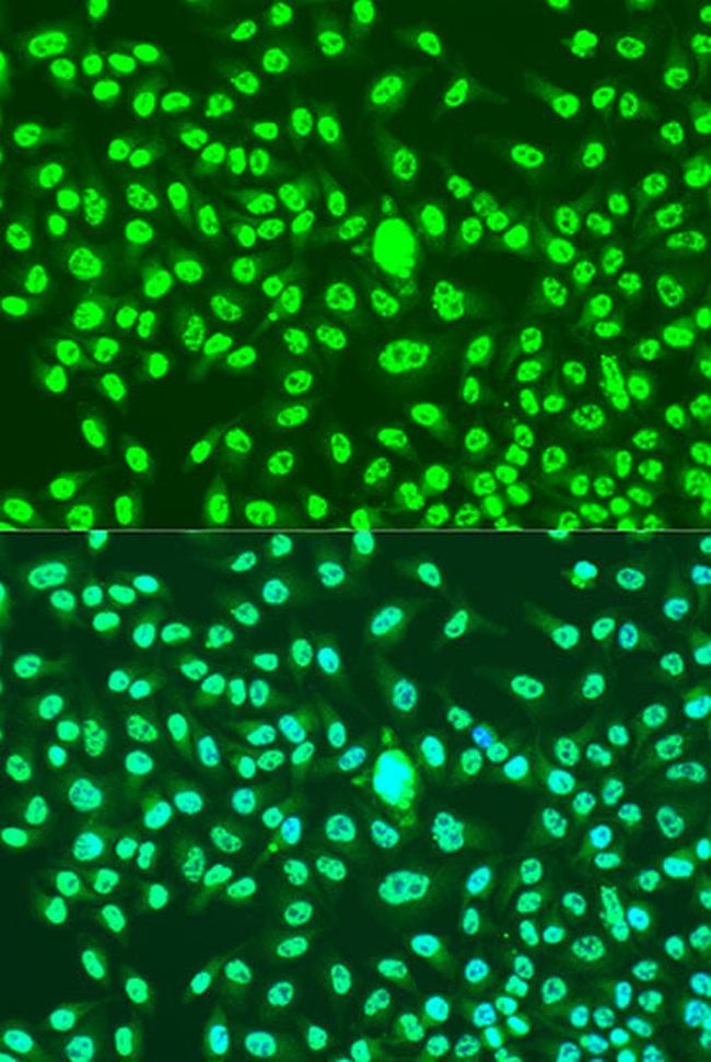 Cyclin A2 Antibody in Immunocytochemistry (ICC/IF)