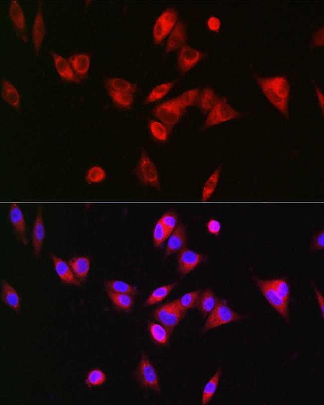 BAAT Antibody in Immunocytochemistry (ICC/IF)