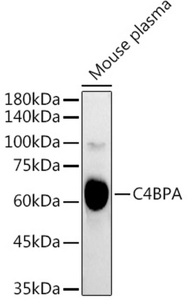 C4BPA Antibody in Western Blot (WB)