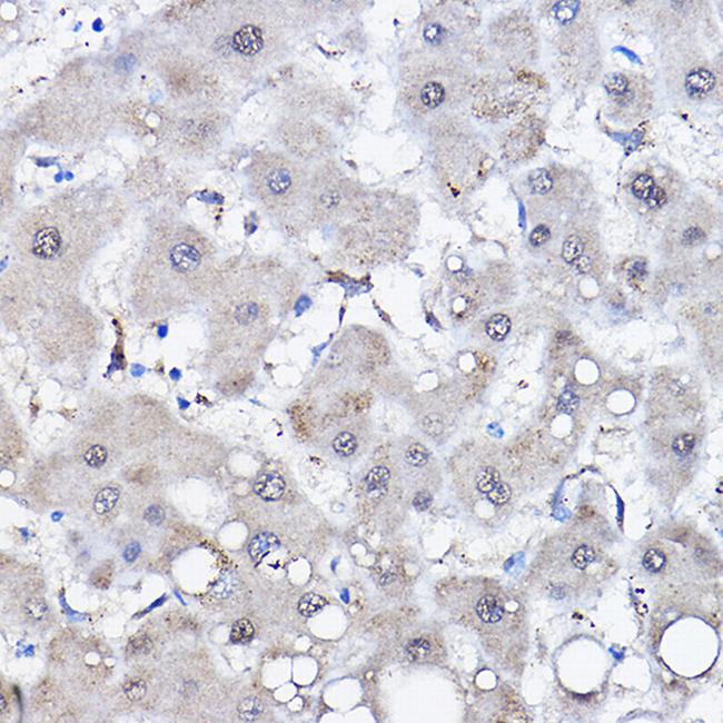 HSPA6 Antibody in Immunohistochemistry (Paraffin) (IHC (P))