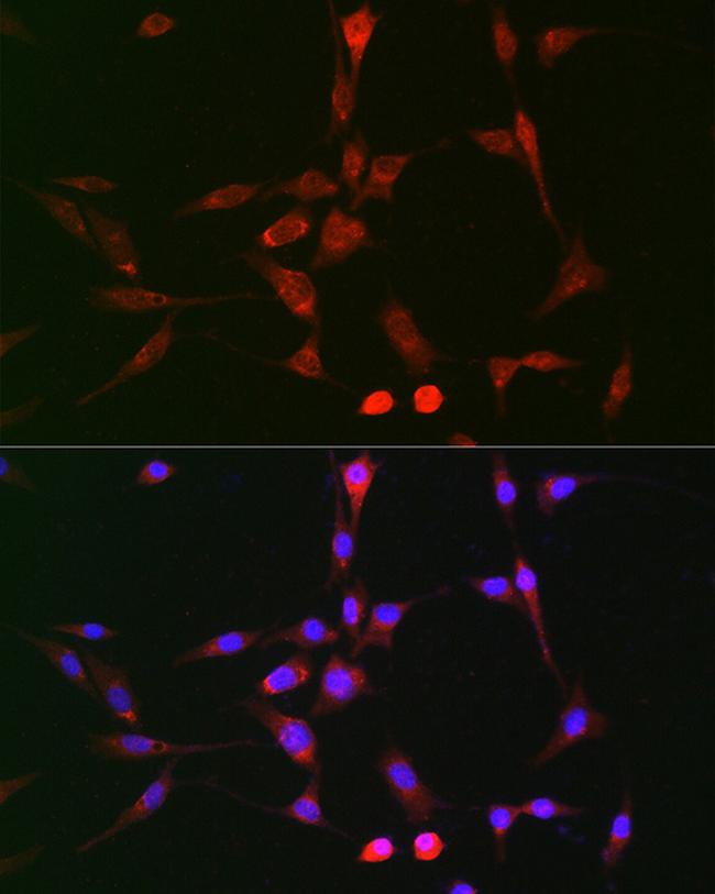 LOX Antibody in Immunocytochemistry (ICC/IF)