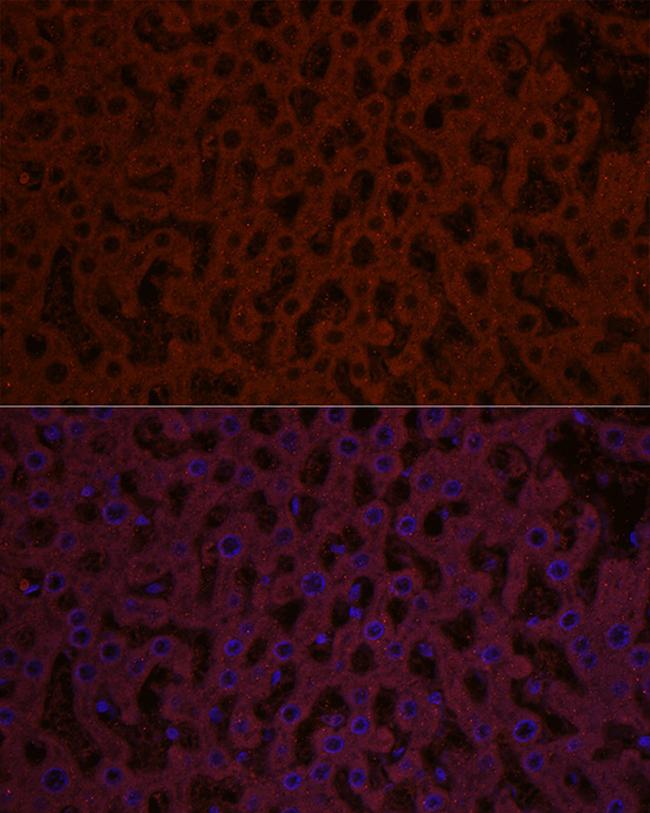 SHH Antibody in Immunocytochemistry (ICC/IF)