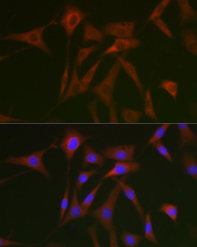 STAT5 alpha Antibody in Immunocytochemistry (ICC/IF)