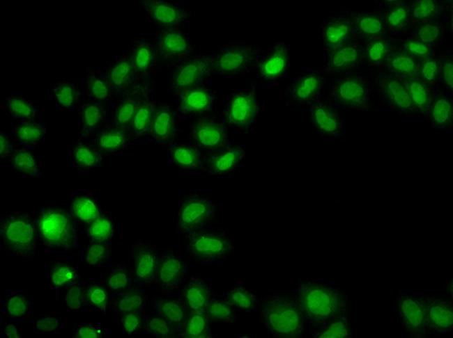 SULT2B1 Antibody in Immunocytochemistry (ICC/IF)