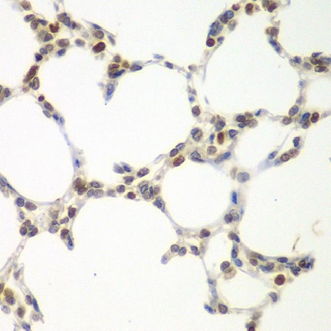 VRK1 Antibody in Immunohistochemistry (Paraffin) (IHC (P))