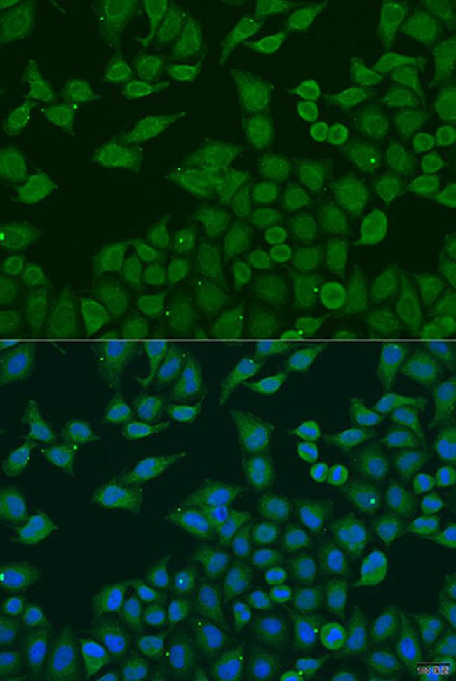 PLA2G4C Antibody in Immunocytochemistry (ICC/IF)