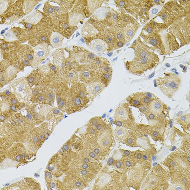 NAT8 Antibody in Immunohistochemistry (Paraffin) (IHC (P))