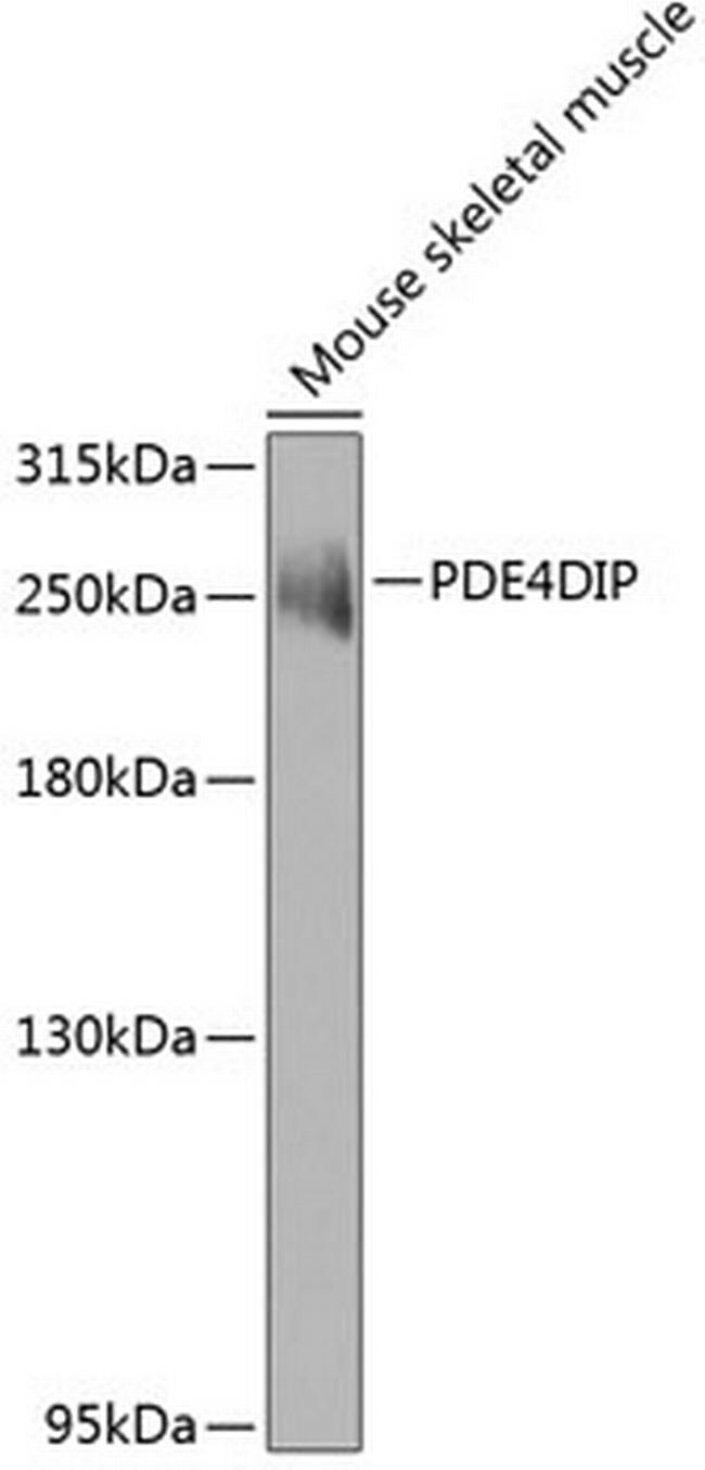 Myomegalin Antibody in Western Blot (WB)