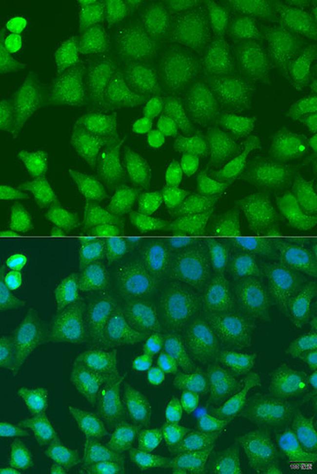 ZFYVE16 Antibody in Immunocytochemistry (ICC/IF)