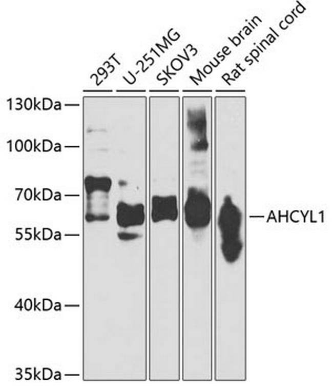 AdoHcyase 2 Antibody in Western Blot (WB)