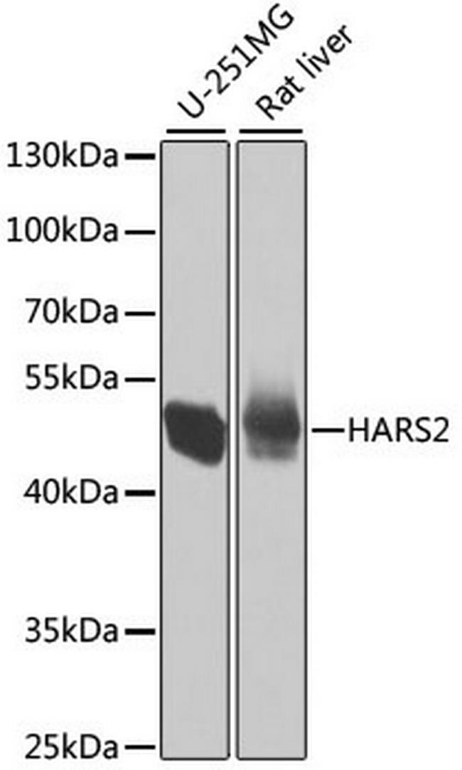 HARS2 Antibody in Western Blot (WB)