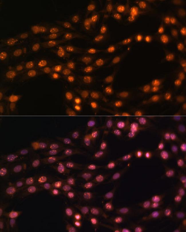 SUZ12 Antibody in Immunocytochemistry (ICC/IF)