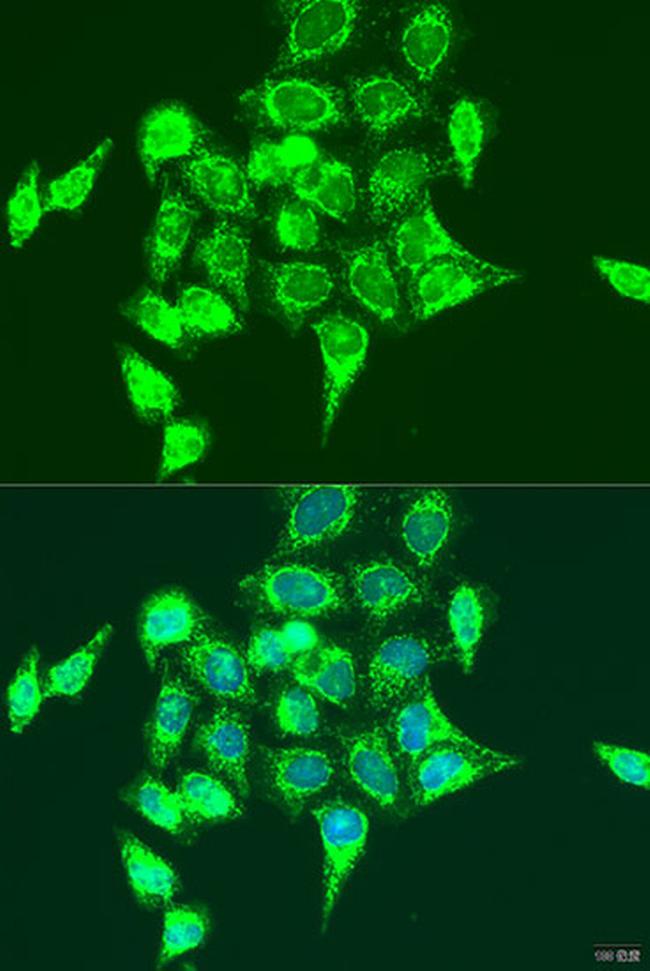 RASGRP3 Antibody in Immunocytochemistry (ICC/IF)