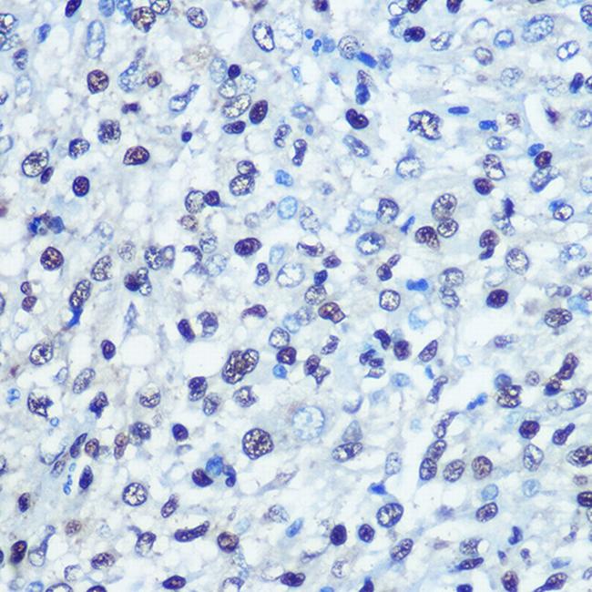 SAMHD1 Antibody in Immunohistochemistry (Paraffin) (IHC (P))