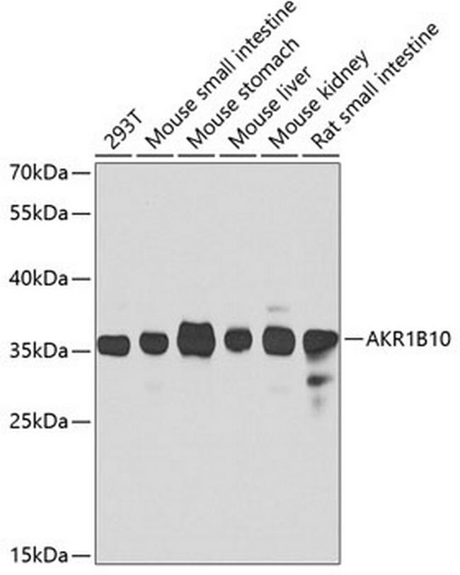 AKR1B10 Antibody in Western Blot (WB)