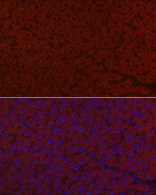 LRG1 Antibody in Immunocytochemistry (ICC/IF)