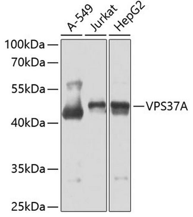 VPS37A Antibody in Western Blot (WB)