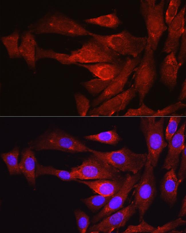 PCSK9 Antibody in Immunocytochemistry (ICC/IF)