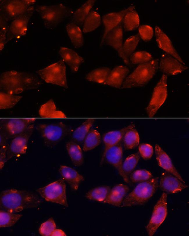 ACVR2B Antibody in Immunocytochemistry (ICC/IF)