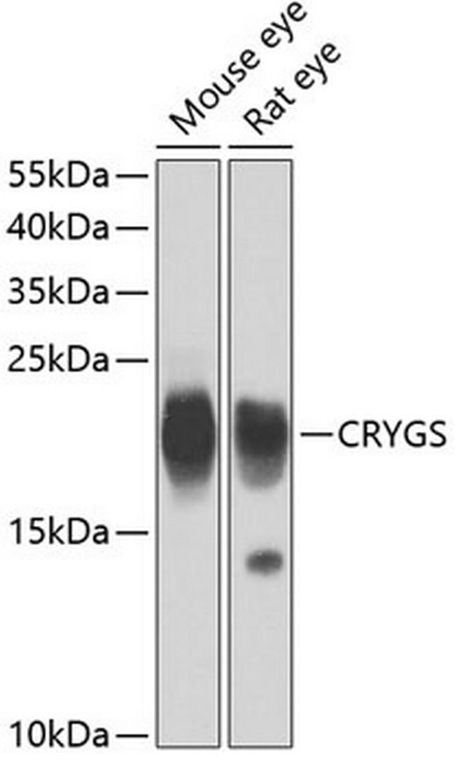 CRYGS Antibody in Western Blot (WB)