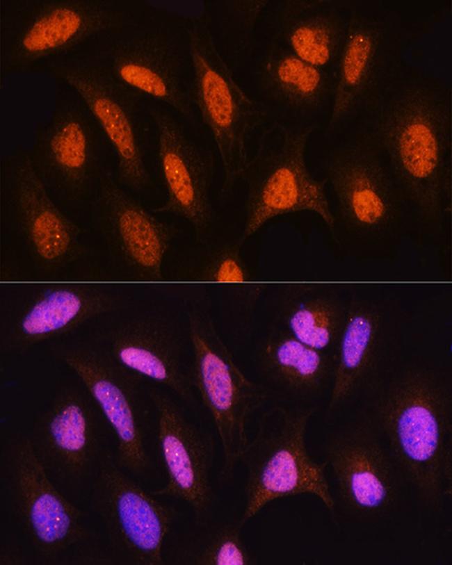 HSPA2 Antibody in Immunocytochemistry (ICC/IF)