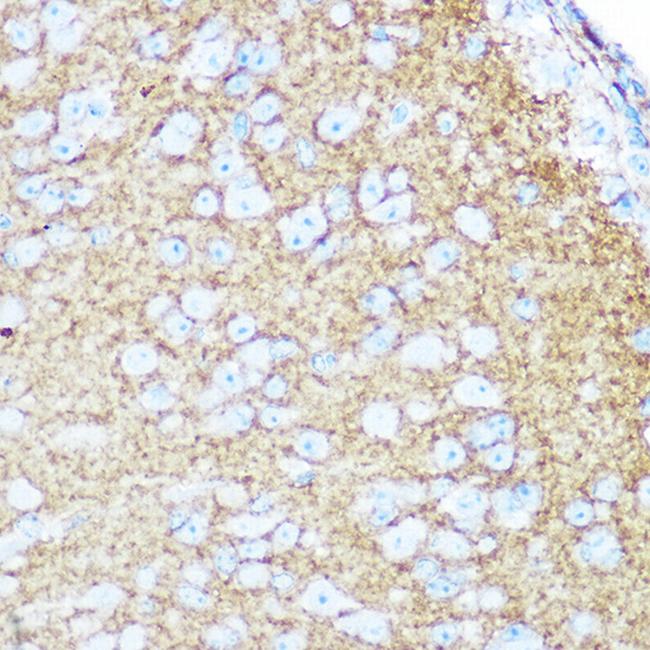 CD56 Antibody in Immunohistochemistry (Paraffin) (IHC (P))