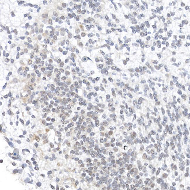 OCT3/4 Antibody in Immunohistochemistry (Paraffin) (IHC (P))