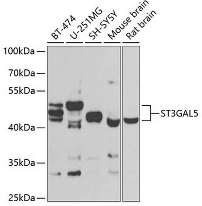 ST3GAL5 Antibody in Western Blot (WB)