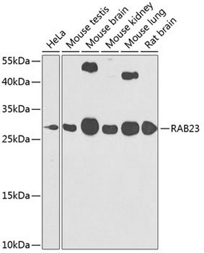 RAB23 Antibody in Western Blot (WB)