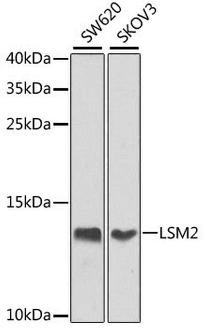 LSM2 Antibody in Western Blot (WB)