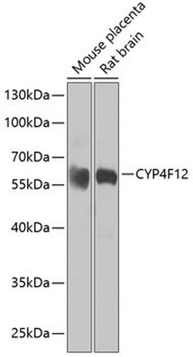 CYP4F12 Antibody in Western Blot (WB)