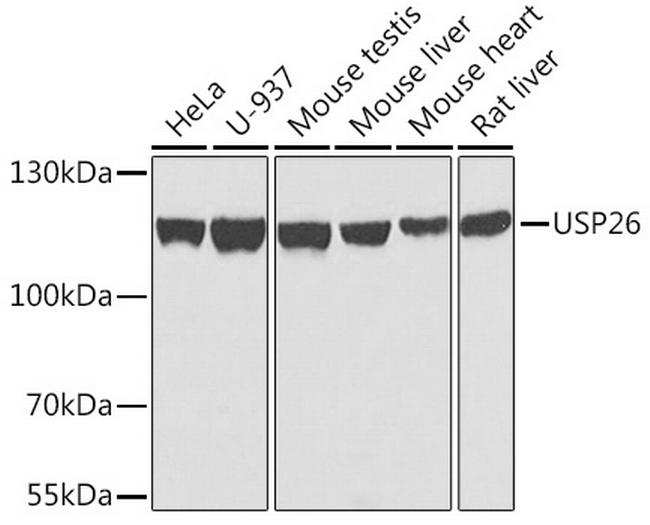 USP26 Antibody in Western Blot (WB)