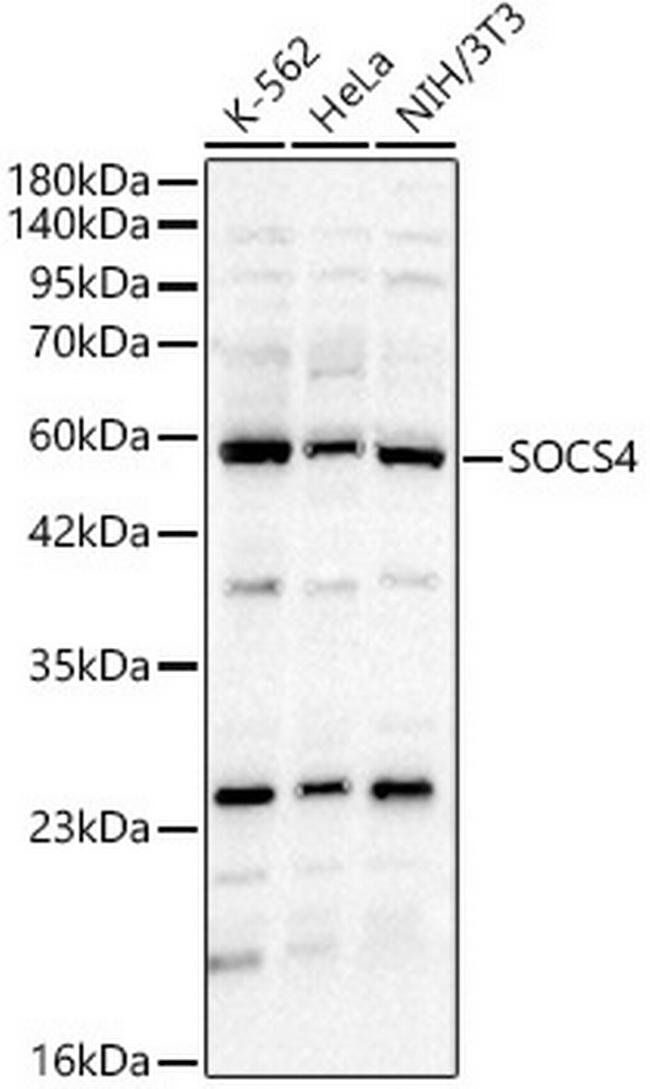 SOCS4 Antibody in Western Blot (WB)