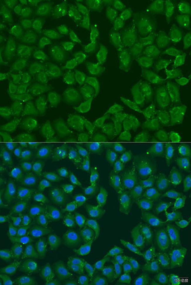 MSRB3 Antibody in Immunocytochemistry (ICC/IF)