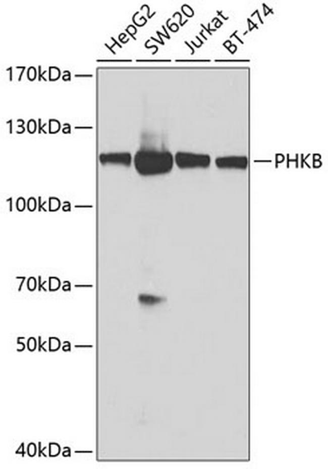 PHKB Antibody in Western Blot (WB)