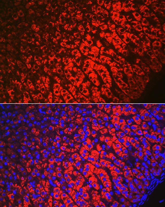 HSD3B1 Antibody in Immunohistochemistry (Paraffin) (IHC (P))