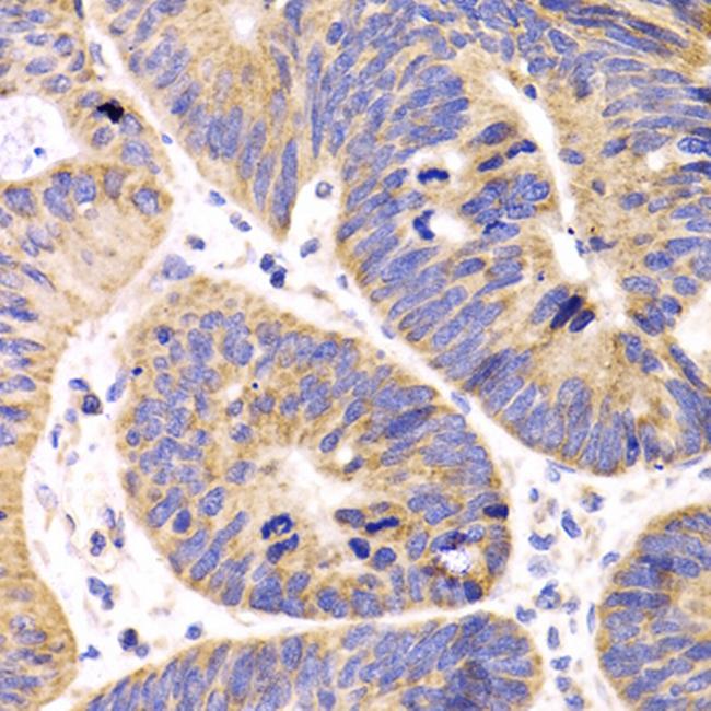 HMGCL Antibody in Immunohistochemistry (Paraffin) (IHC (P))