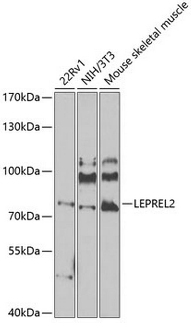 LEPREL2 Antibody in Western Blot (WB)