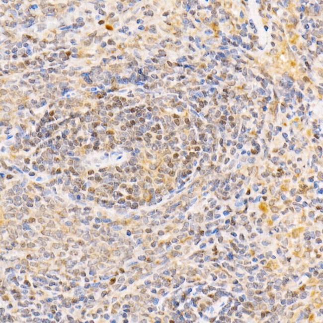 ANAPC2 Antibody in Immunohistochemistry (Paraffin) (IHC (P))