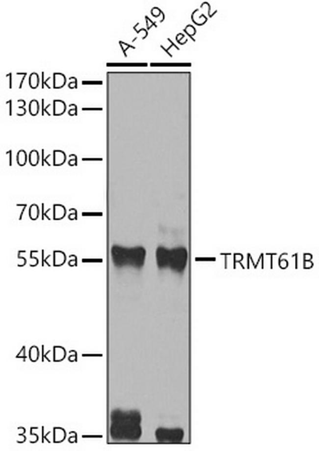 TRMT61B Antibody in Western Blot (WB)